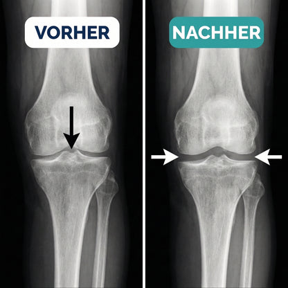 Beende deine Knieschmerzen — in 15 Minuten täglich, ohne OP